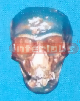 COPPERIZED NEANDERTHAL SKULL